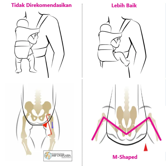 cara menggendong bayi baru lahir yang salah