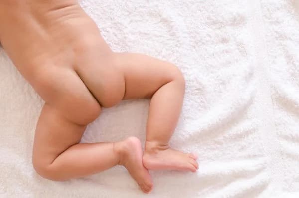 5 Cara Mudah Obati Lecet pada Dubur Bayi!