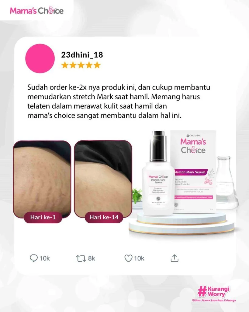 Testimoni Penggunaan Stretch Mark Series, dapat Meminimalisir Stretch Mark dan Linea Nigra