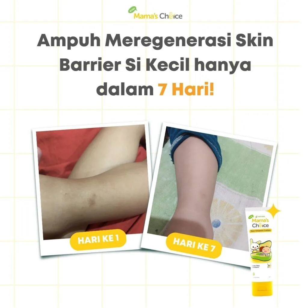 Pilih Lotion Bayi yang Sudah Teruji Aman untuk Si Kecil dengan Kulit Sensitif!