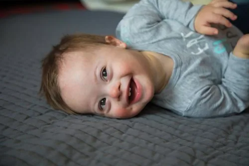 Memahami Ciri Ciri & Perilaku Bayi Down Syndrome