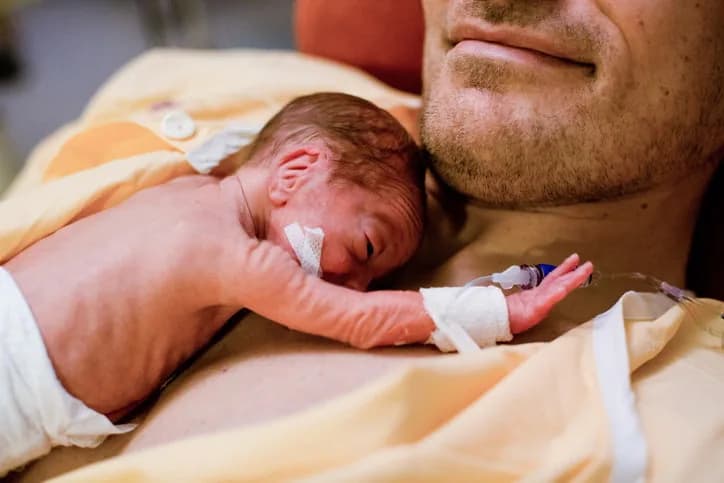 metode kangguru (kangaroo mother care) untuk bayi prematur