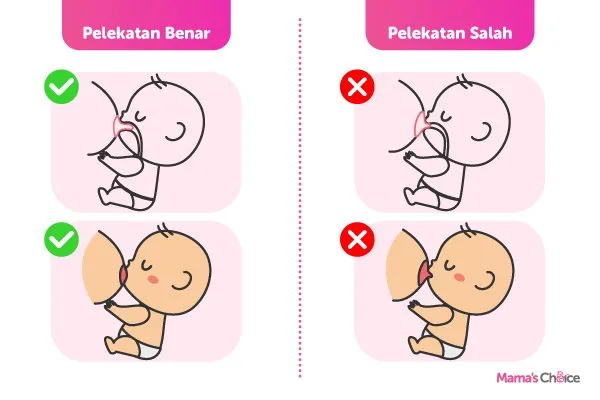 cara pelekatan saat menyusui ASI yang benar dan baik