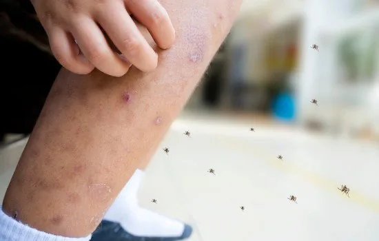 mencegah dan mengatasi darah manis pada anak
