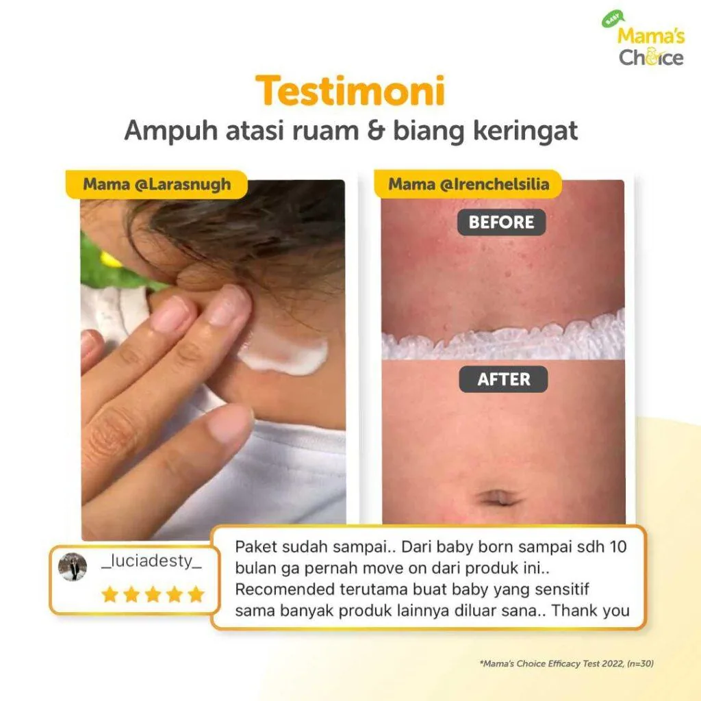 Testimoni krim ruam popok bayi