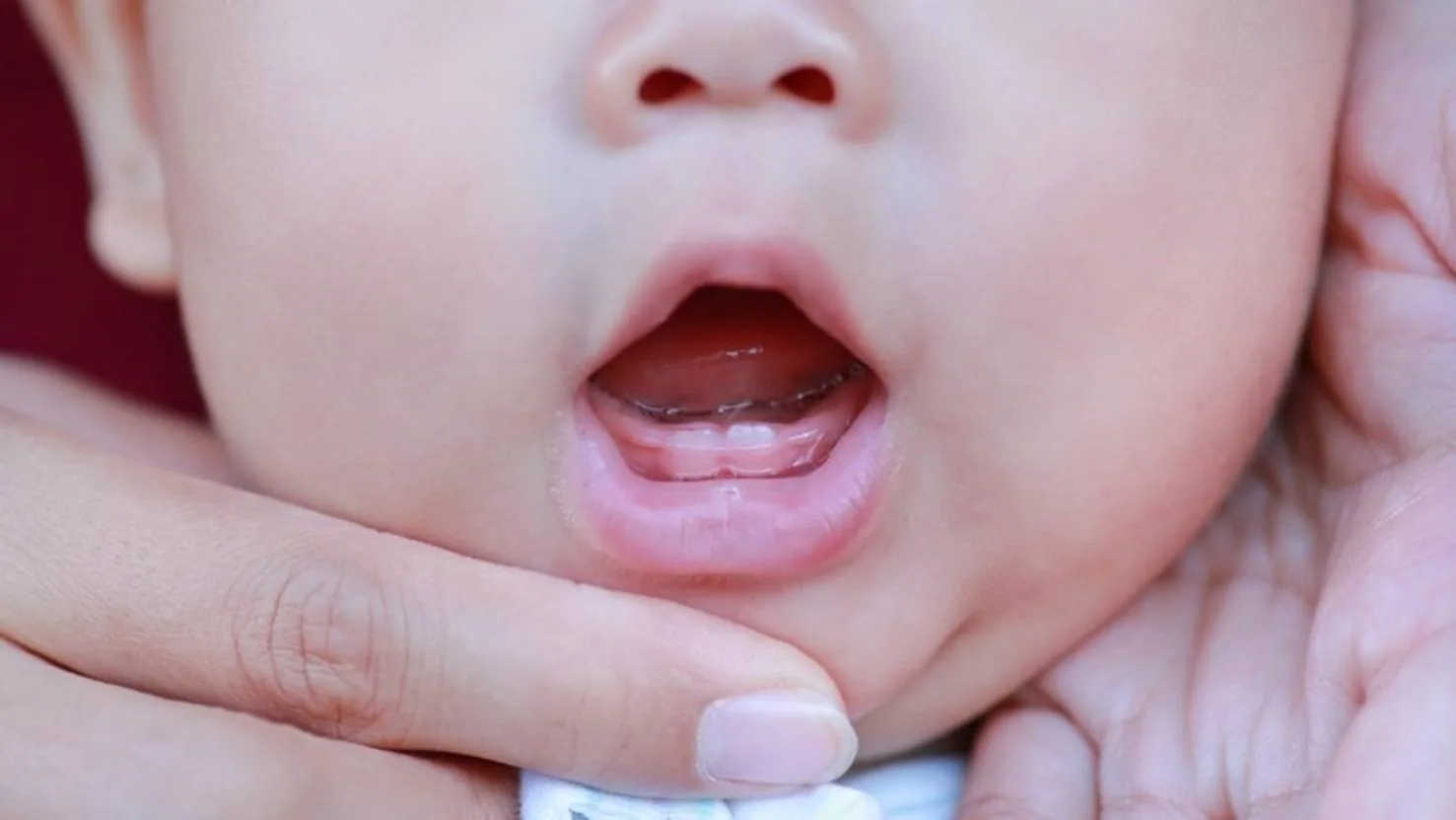 Fluoride Sebabkan Gigi Kuning dan Kusam, Mitos atau Fakta?