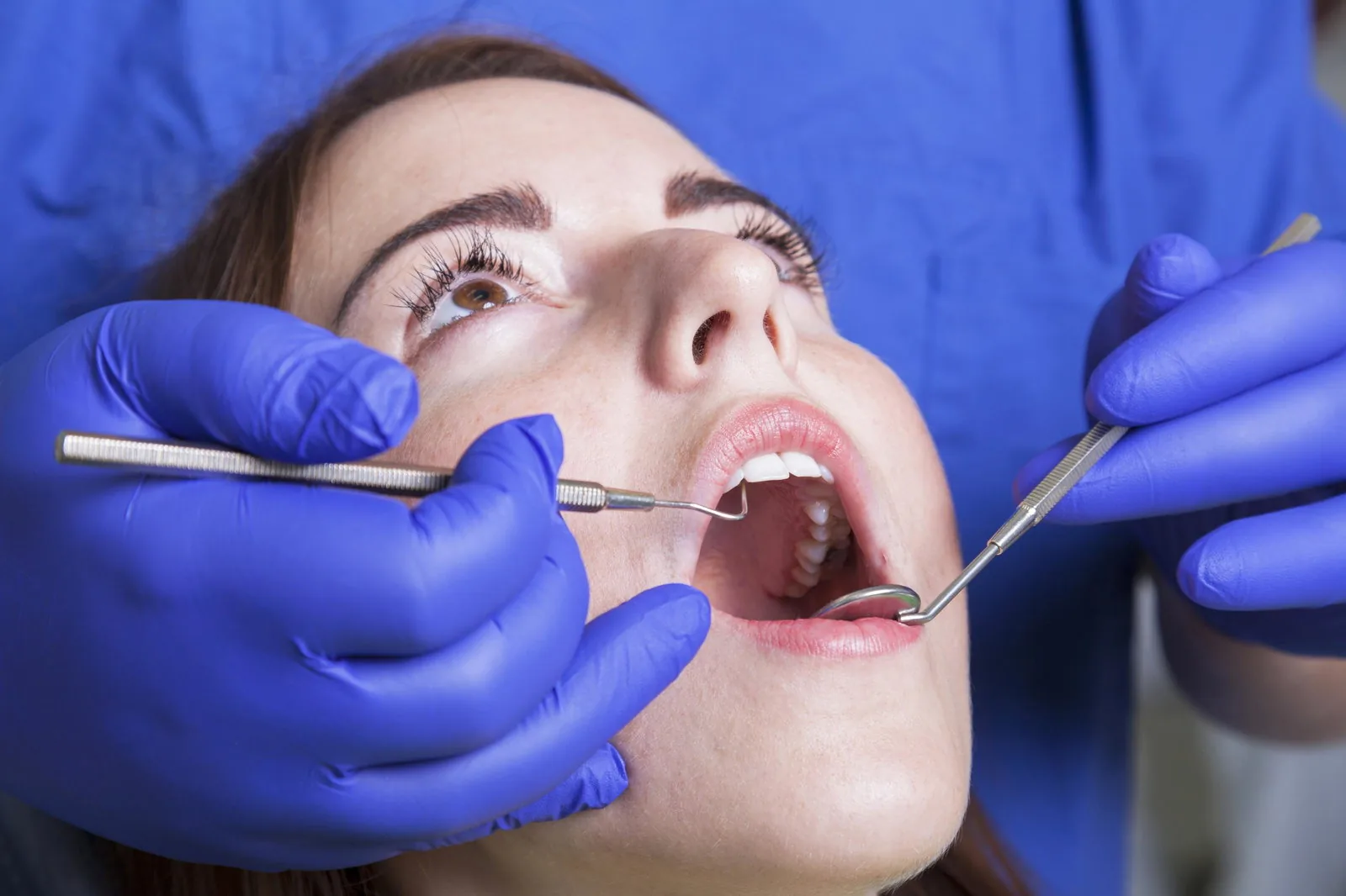 mengatasi gingivitis pada kehamilan