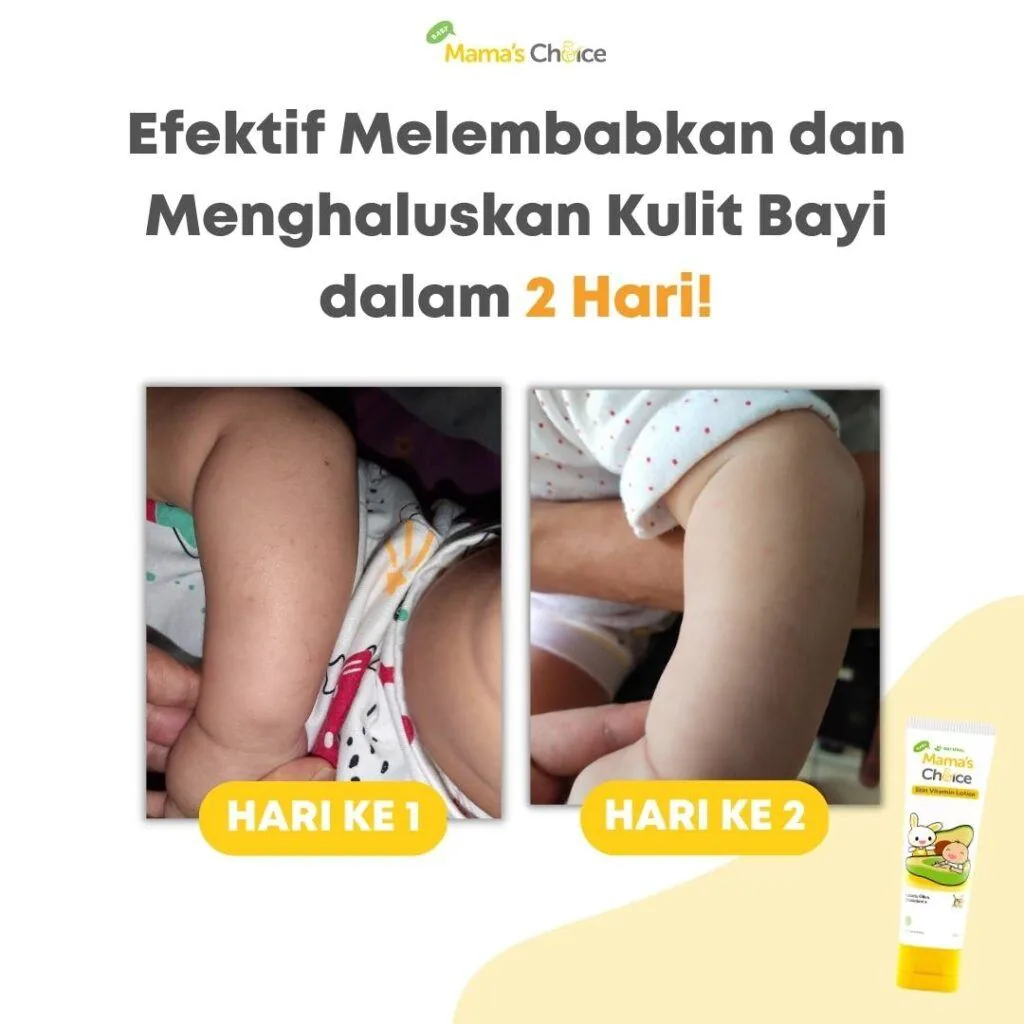 Baby Lotion yang Aman untuk Menutrisi dan Memutihkan Kulit Bayi