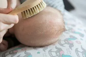 Minyak zaitun dan kulit bayi
