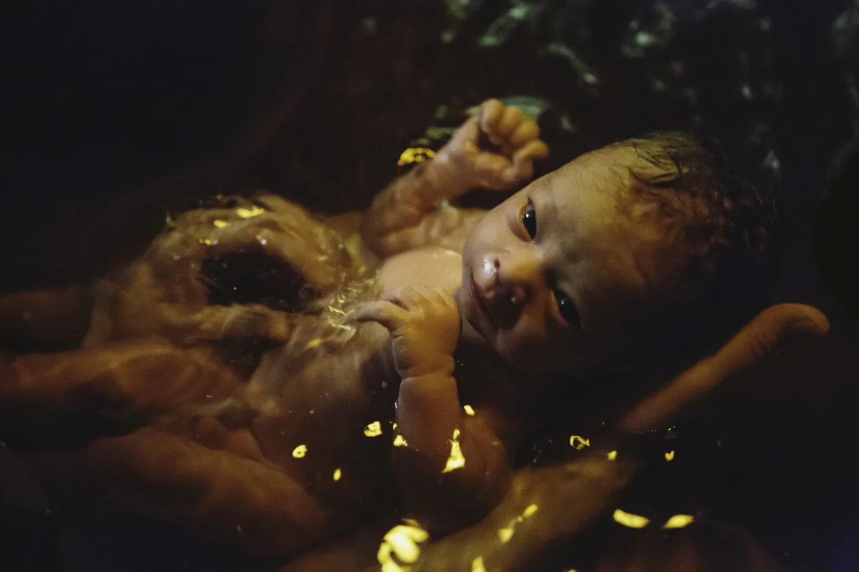 Mengenal Gentle Birth, Persalinan Minim Rasa Sakit