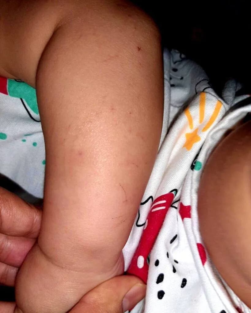 Curhatan Mama Wulan Berhasil Regenerasi Skin Barrier Si