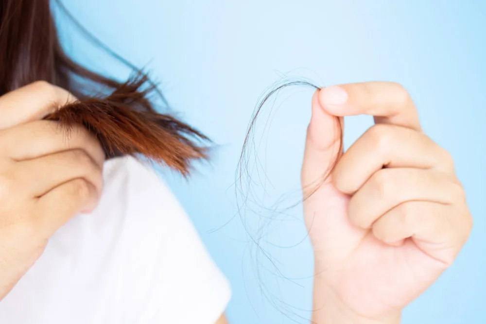 Rambut rontok saat hamil - Mama