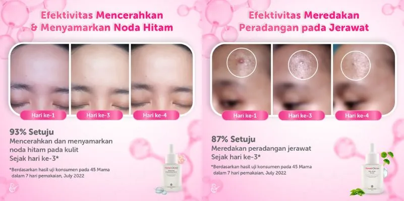 Efektivitas Mama’s Choice Face Serum pada Kulit