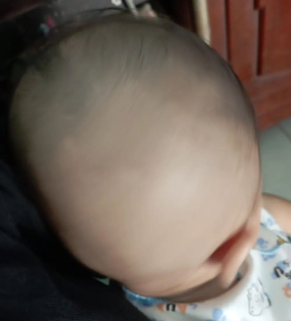 Rambut si Kecil, sebelum dan hari ke-14, Sebelum