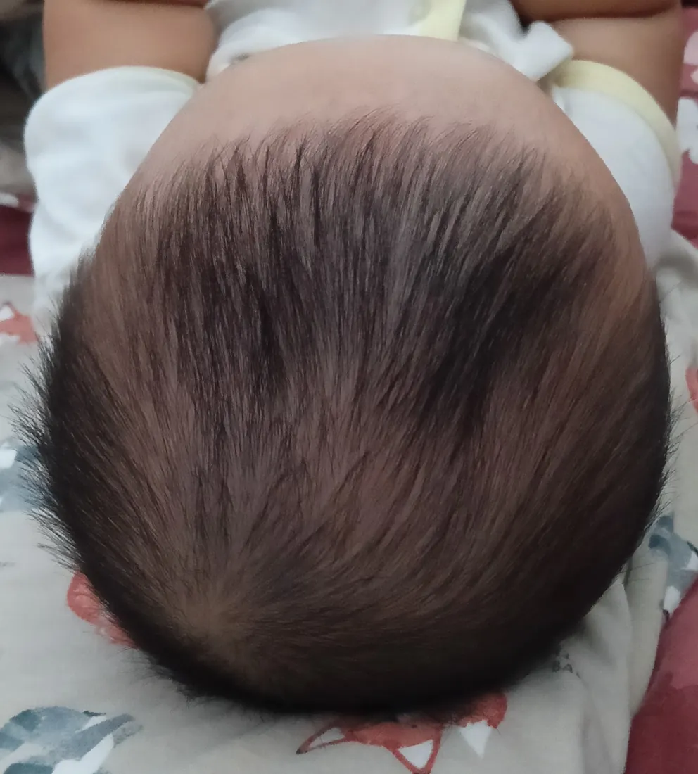 Rambut si Kecil, sebelum dan hari ke-14, Hari ke-14