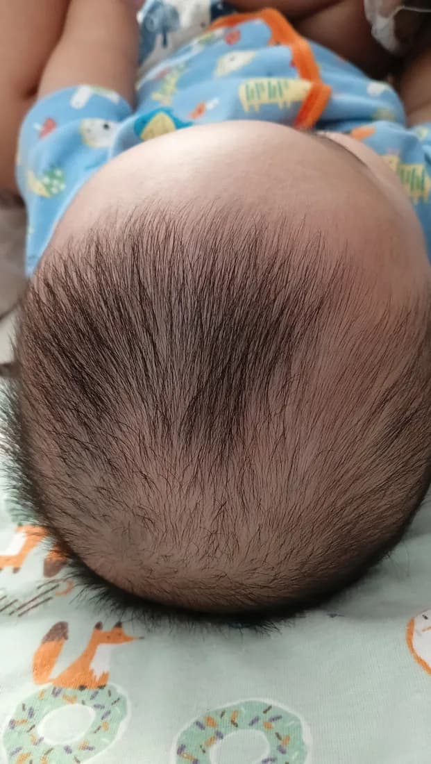 Rambut si Kecil, sebelum dan hari ke-14, Sebelum