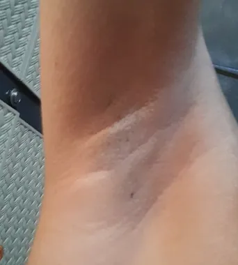 Hasil dalam 3 minggu, Sebelum