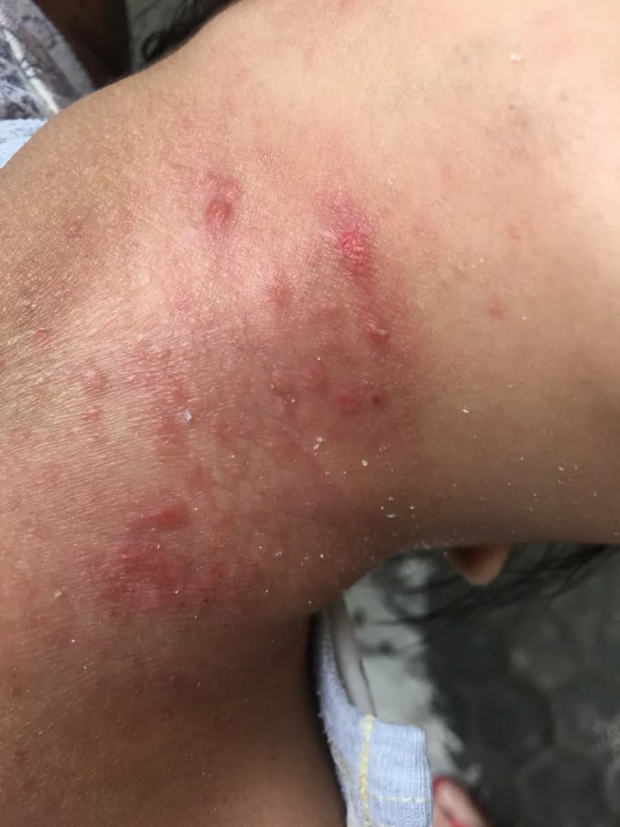 Hasil dalam 3 kali pemakaian, Sebelum