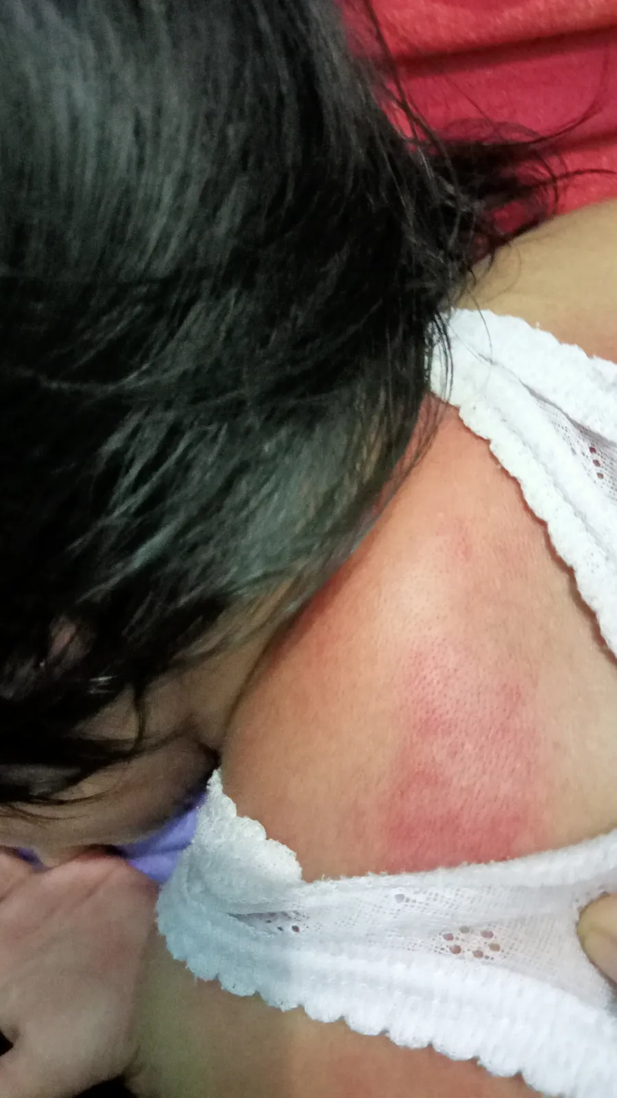 Hasil dalam 3 kali pemakaian, Sebelum