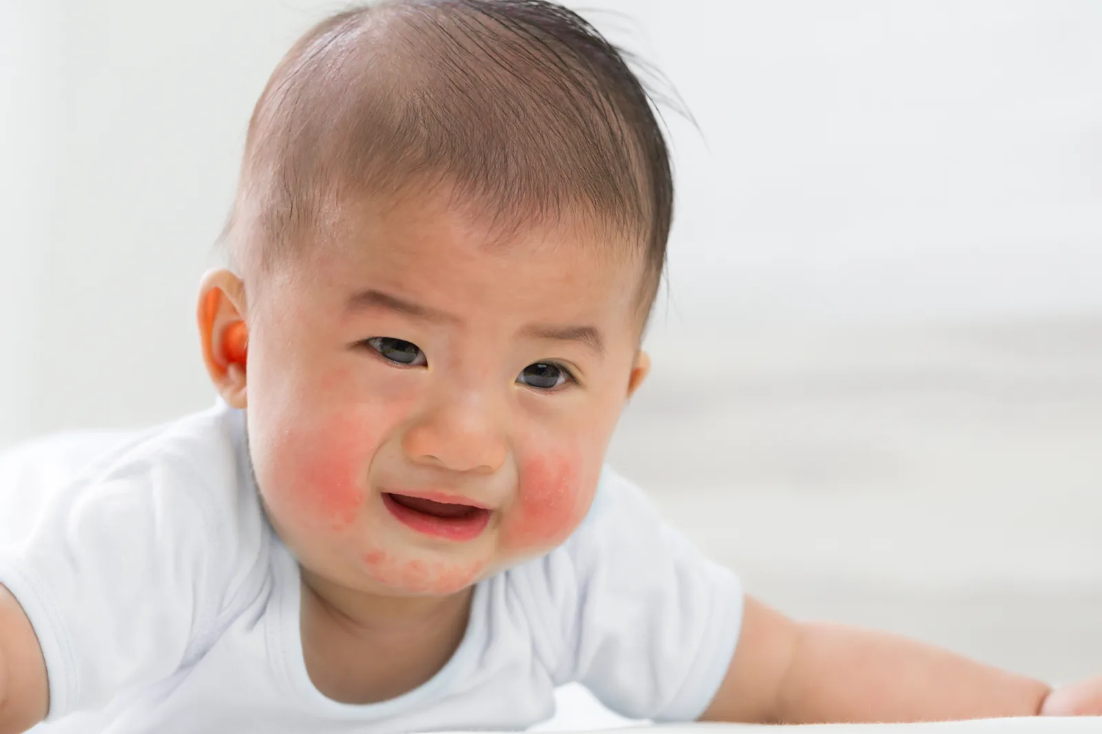 Bayi dengan pipi kemerahan