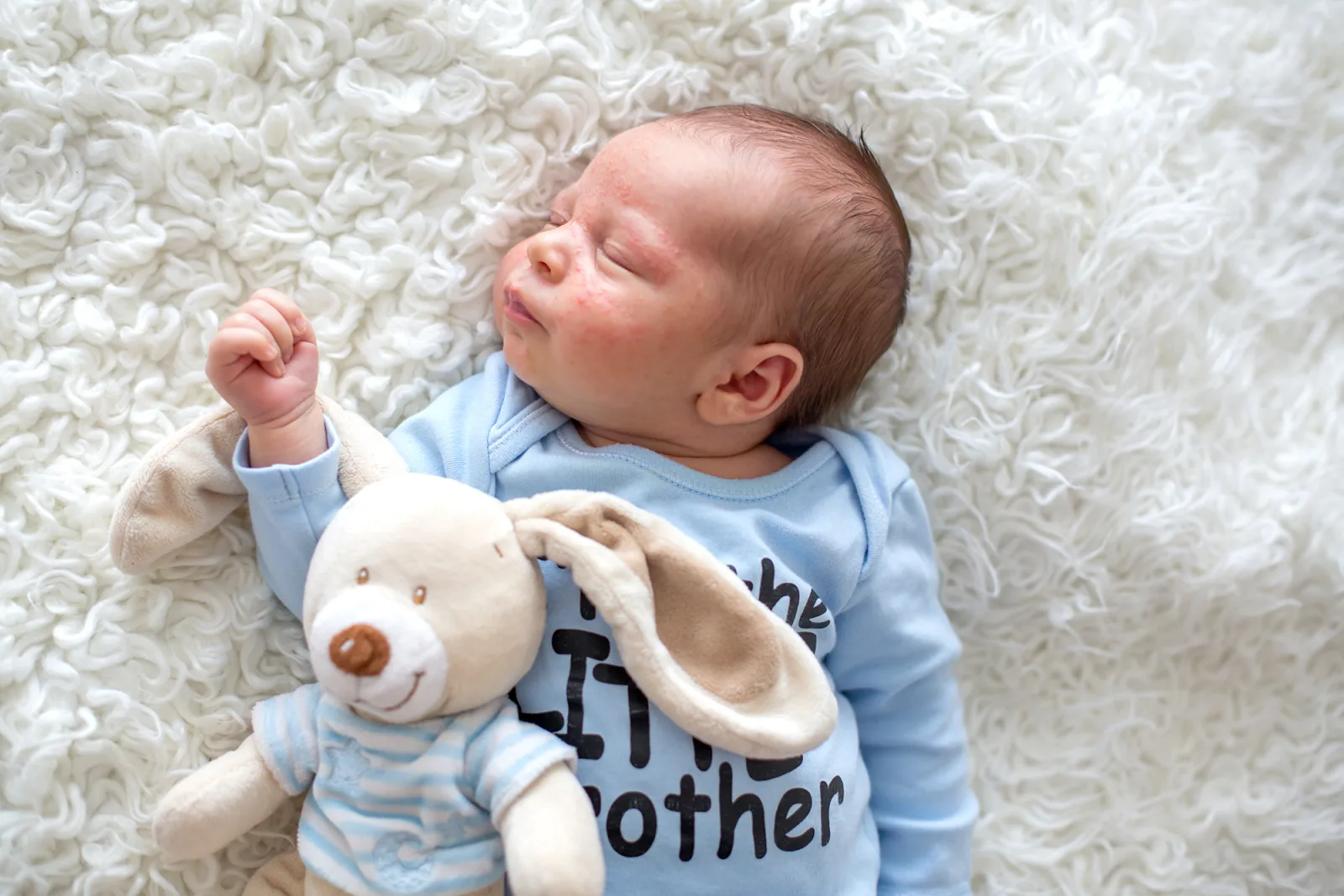 Keringat buntet pada kulit bayi