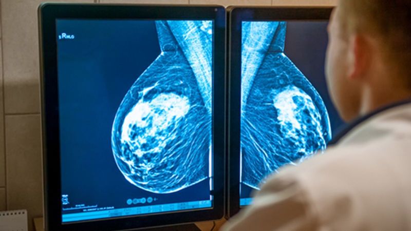 paraben menyebabkan kanker payudara