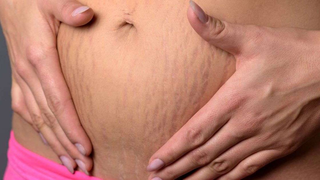 Tips mengatasi masalah kulit saat hamil