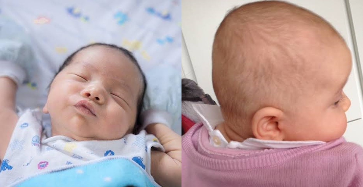  Kepala  Bayi  Peyang Segera Atasi dengan 5 Cara Ini