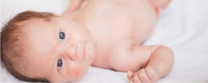 cara menghilangkan ruam susu ASI pada wajah bayi