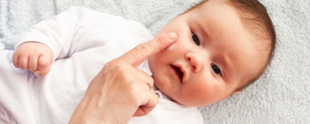 cara cepat mengatasi keringat buntet pada bayi dengan salep