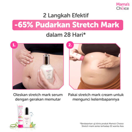 2 Steps | Stretch Mark Treatment Series Mama's Choice (Stretch Mark Cream + Stretch Mark Serum) Obat Krim Strechmark Terdaftar BPOM